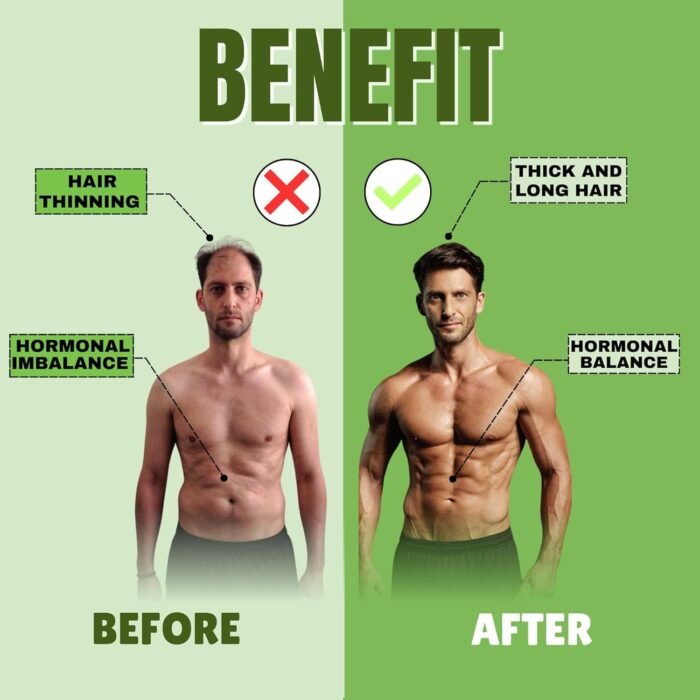 BOIC Saw Palmetto Prostate Support | Extra Strength with Pygeum, Pumpkin Seed Oil, Stinging Nettle, Sunflower Lecithin & Cranberry – Selenium, Zinc & Lycopene – 90 Capsules